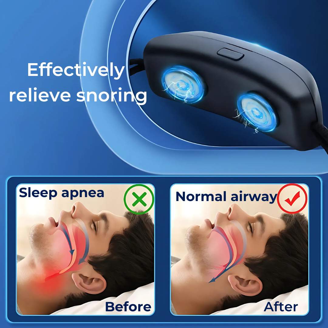 DreamEase Smart Anti-Snoring Device - With Sleep Monitoring