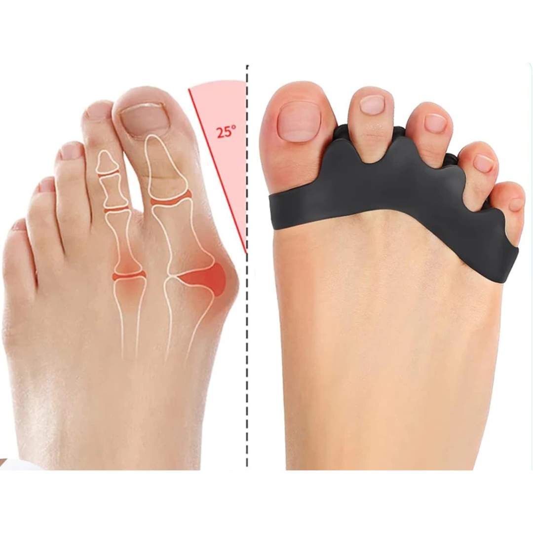 FlexAlign Toe Spacer Alignment - Ideal for Bunions