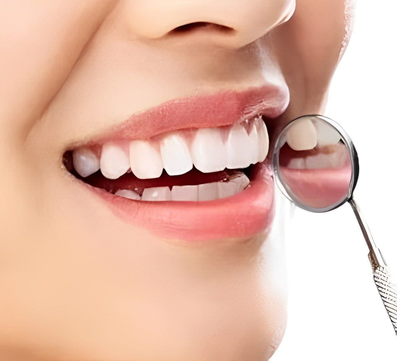 Instant Smile Cosmetic Teeth Set - Top & Bottom Veneer Look