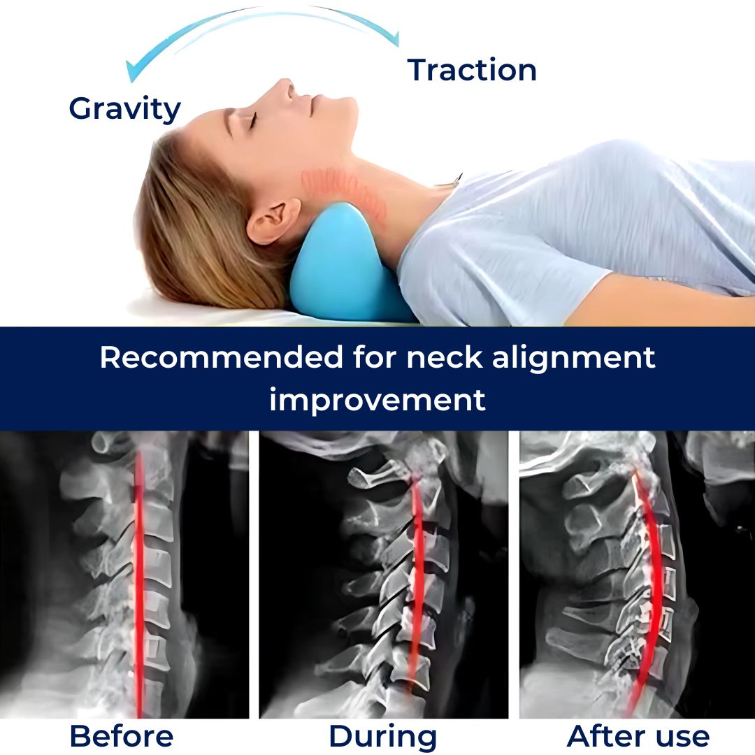 NeckAlign Neck Pillow Stretcher for Neck Tension