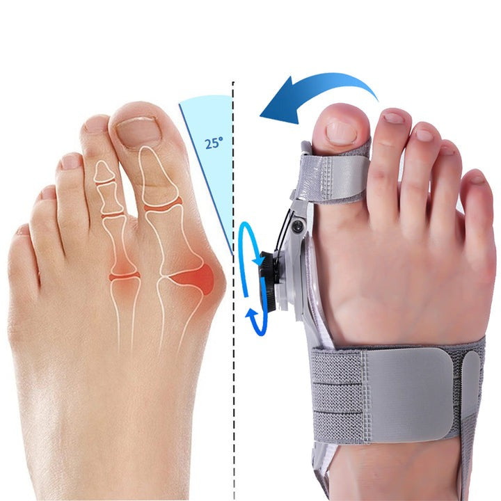 Nvroome Bunion Fix Corrector