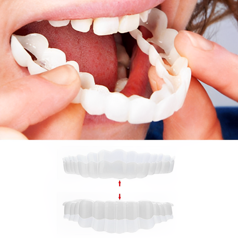Clip-On Smile Veneers - Upper & Lower Set