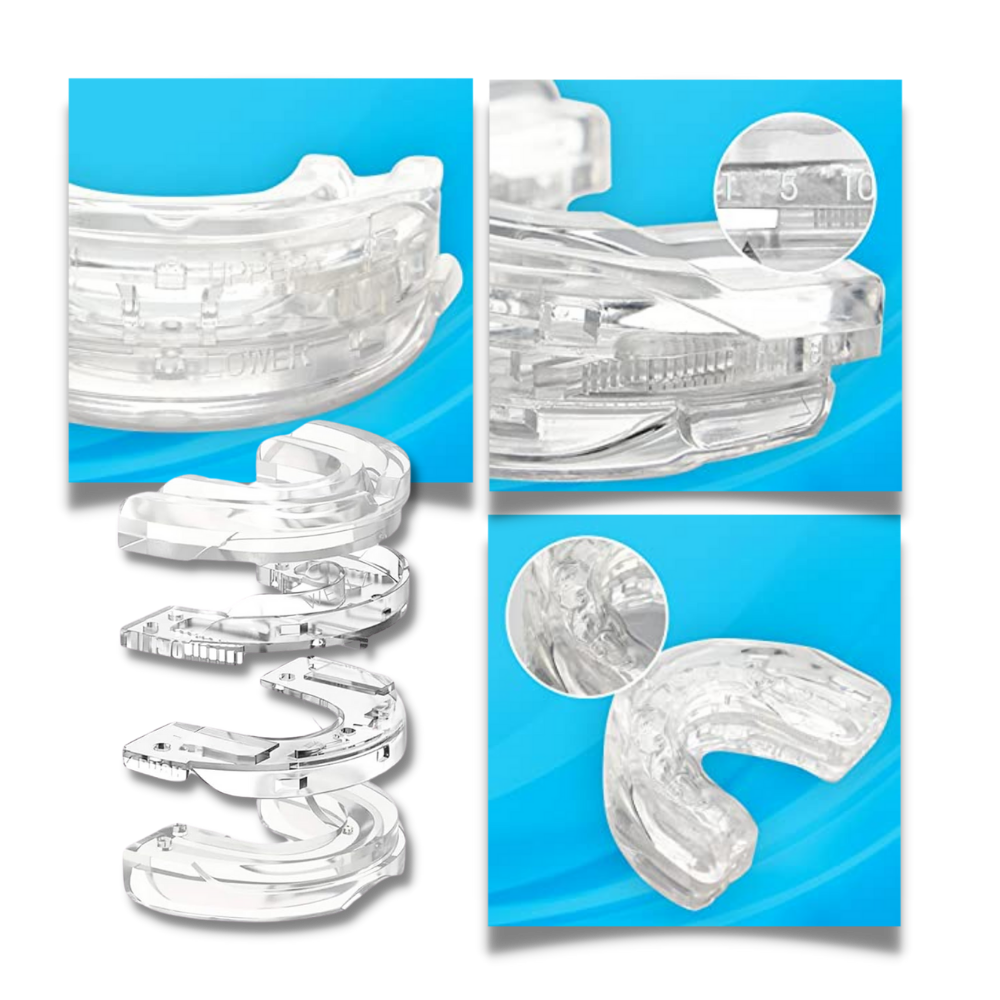 Advanced Anti-Snoring Mouthpiece Device