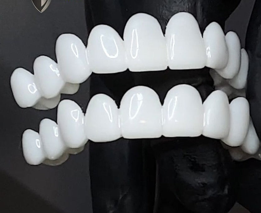 SmileFix Dental Prosthesis - Cosmetic Tooth Overlay
