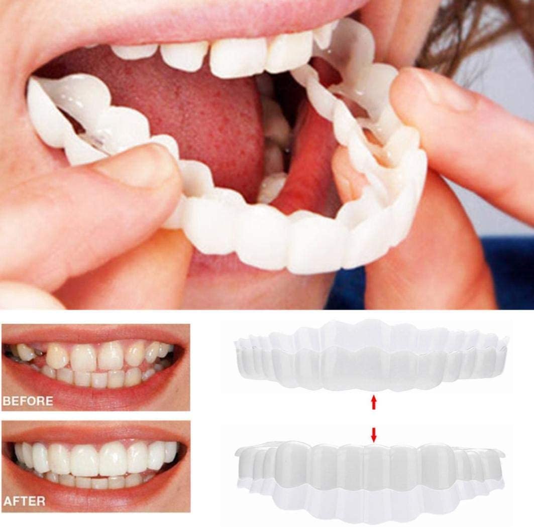 Clip-On Smile Veneers - Upper & Lower Set