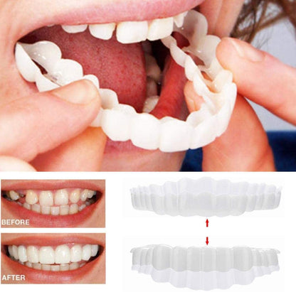 Clip-On Smile Veneers - Upper & Lower Set