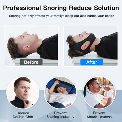 Anti Snoring Chin Strap for Better Sleep Posture