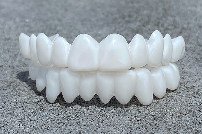 SmileFix Dental Prosthesis - Cosmetic Tooth Overlay