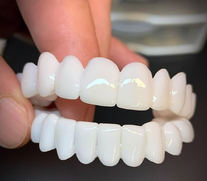 SmileFix Dental Prosthesis - Cosmetic Tooth Overlay