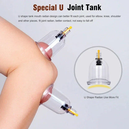 32-Glass Vacuum Cupping Set - Full Body Massage Kit