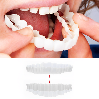 Clip-On Smile Veneers - Upper & Lower Set