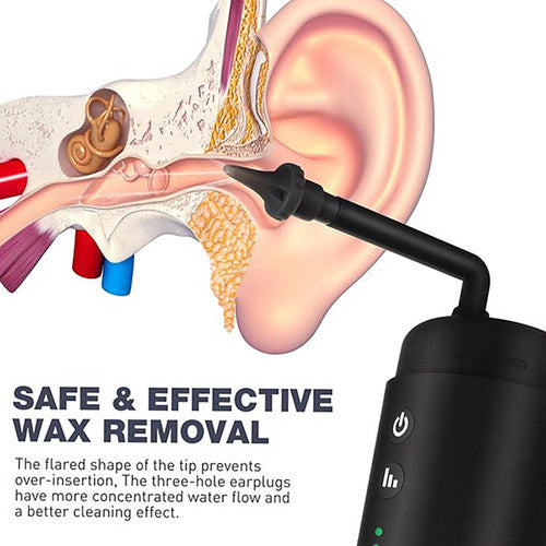 USB Electric Ear Washer - Gentle Irrigation & Ear Cleaning Kit