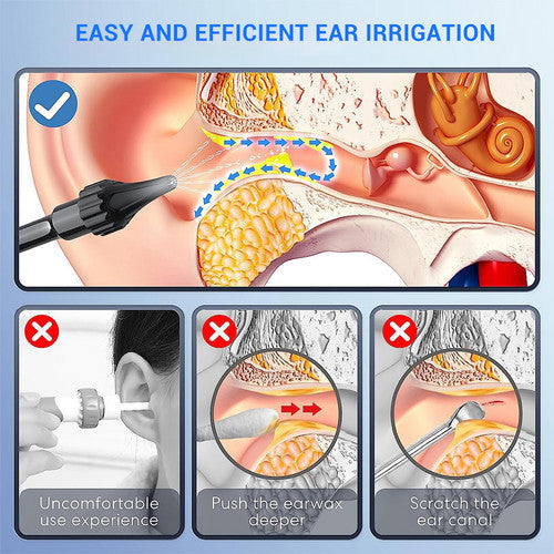 USB Electric Ear Washer - Gentle Irrigation & Ear Cleaning Kit