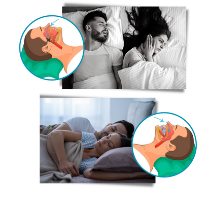 Advanced Anti-Snoring Mouthpiece Device