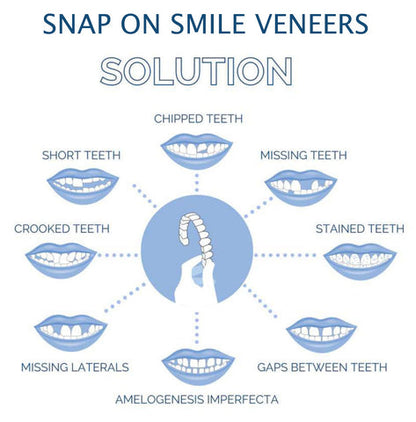 Clip-On Smile Veneers - Upper & Lower Set